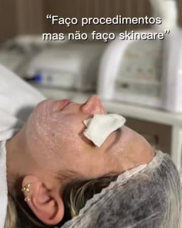 Reel: procedimento sem skincare em casa